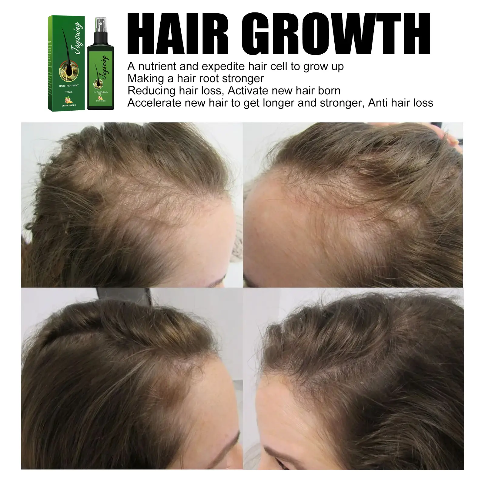 The Ultimate Solution to Baldness: Jaysuing Hair Densifying Liquid