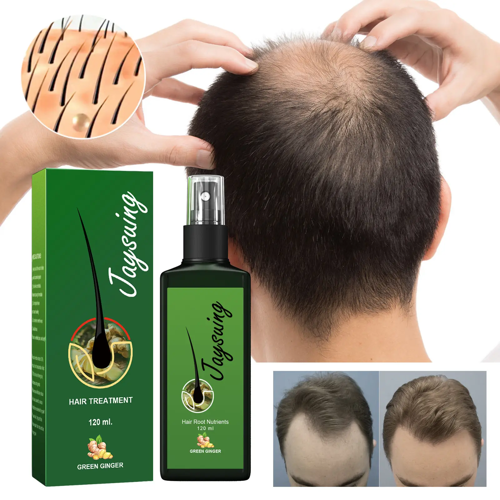 The Ultimate Solution to Baldness: Jaysuing Hair Densifying Liquid