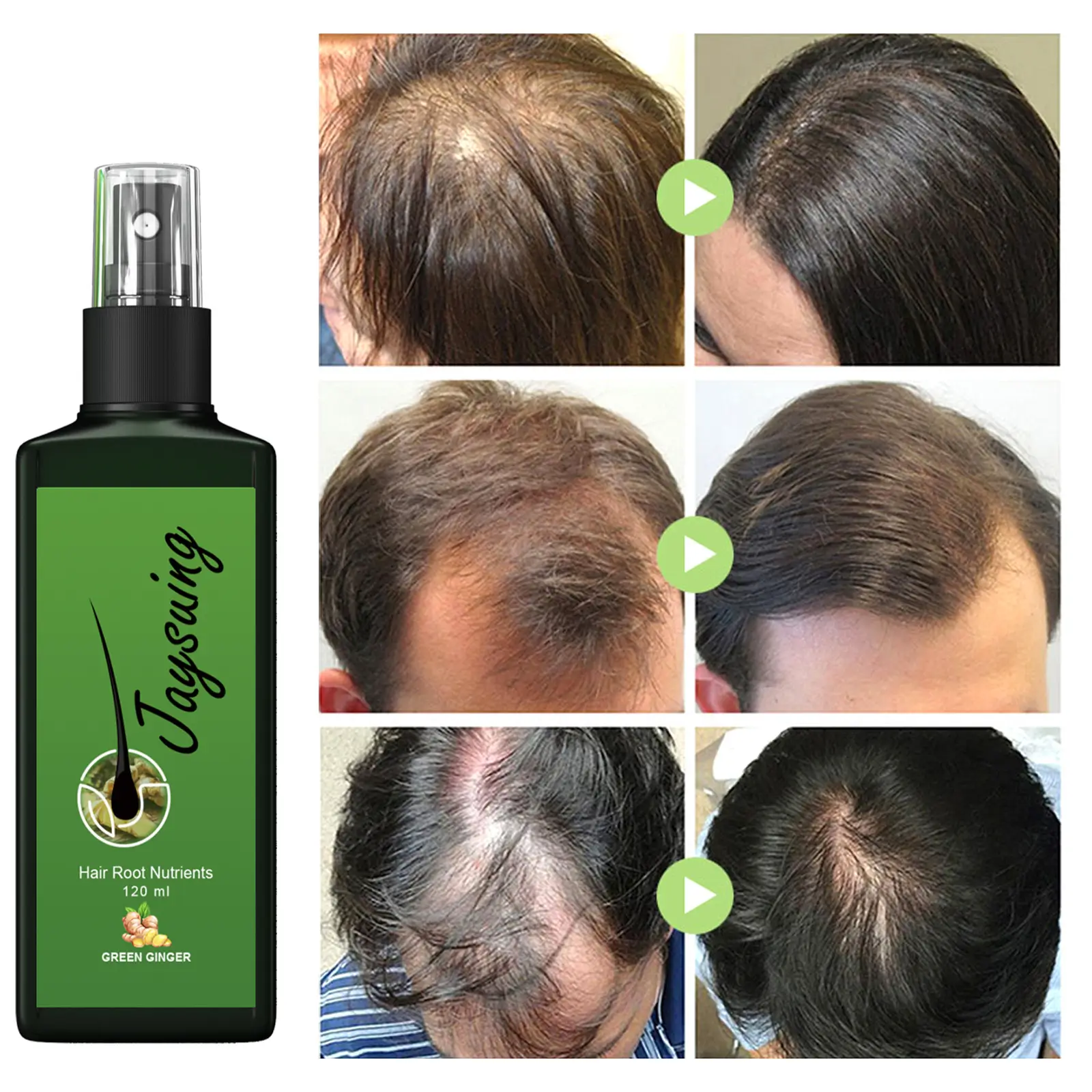 The Ultimate Solution to Baldness: Jaysuing Hair Densifying Liquid